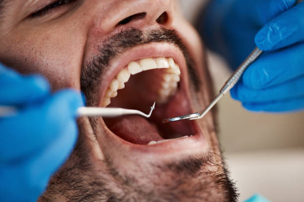 Best Emergency Dental Care for Broken or Chipped Teeth in Marthasville, MO