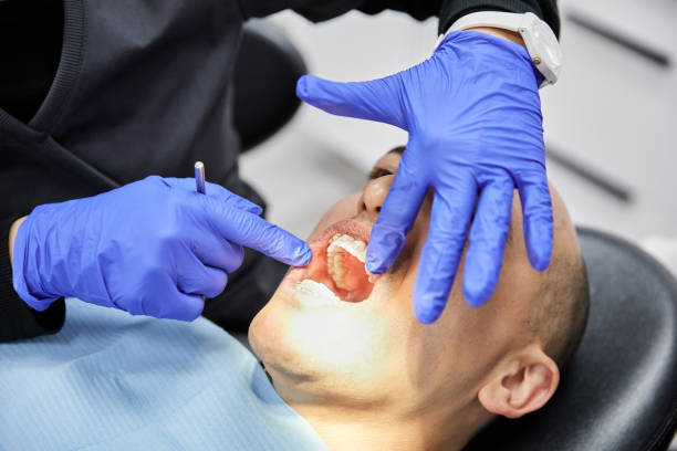 Best Emergency Tooth Extraction in Marthasville, MO