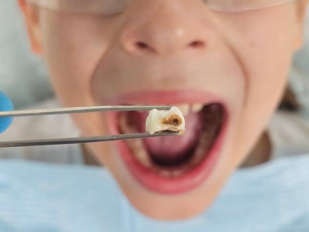 Best Pediatric Emergency Dentist in Marthasville, MO